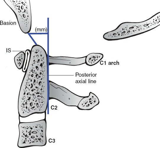 Fonte: Rockwood and Green's Fractures in Adults, 10ª ed., capítulo 48, figura 48-2.