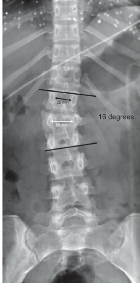 Fonte: Rockwood and Green's Fractures in Adults, 10ª ed., capítulo 49, figura 49-3A.