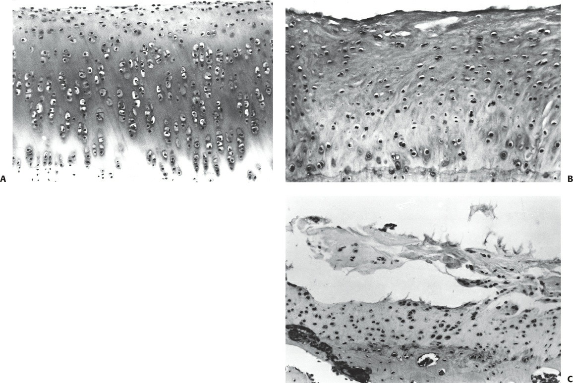 Fonte: Rockwood and Green's Fractures in Adults, 10ª ed., capítulo 2, figura 2-9.
