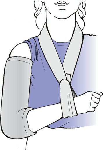 Fonte: Rockwood and Green's Fractures in Adults, 10ª ed., capítulo 10, figura 10-14.