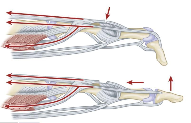 Fonte: AZAR, F. M.; BEATY, J. H. Campbell’s operative orthopaedics. 14. ed. Philadelphia: