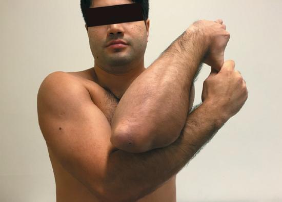 Fonte: MOTTA FILHO, G. R.; BARROS FILHO, T. E. P. Ortopedia e Traumatologia. 1. ed. Rio de Janeiro: Elsevier, 2018.