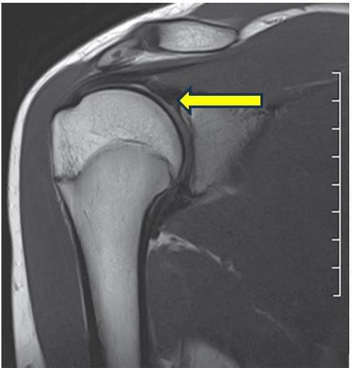Fonte: NETTER, F. H. Atlas de anatomia humana. 7. ed. Rio de Janeiro: Elsevier, 2019.