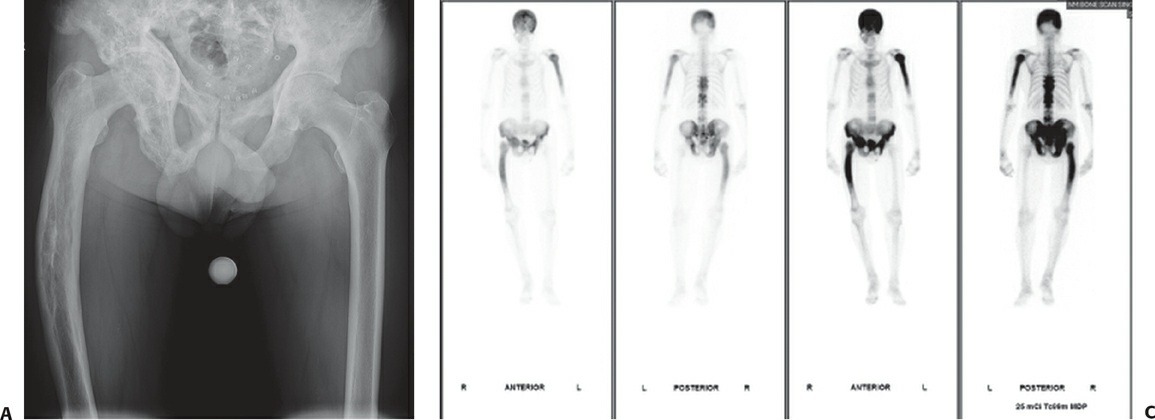 Fonte: Rockwood and Green's Fractures in Adults, 10ª ed., capítulo 4, figura 4-5A e C.