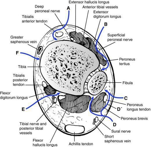 Fonte: TORNETTA III, P.; RICCI, W. M.; OSTRUM, R. F.; McKEE, M. D.; OLIVERE B. J.; RIDDER,