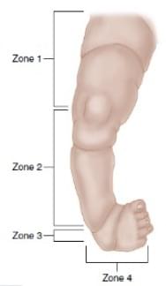 Figura da questão pediatria-0149