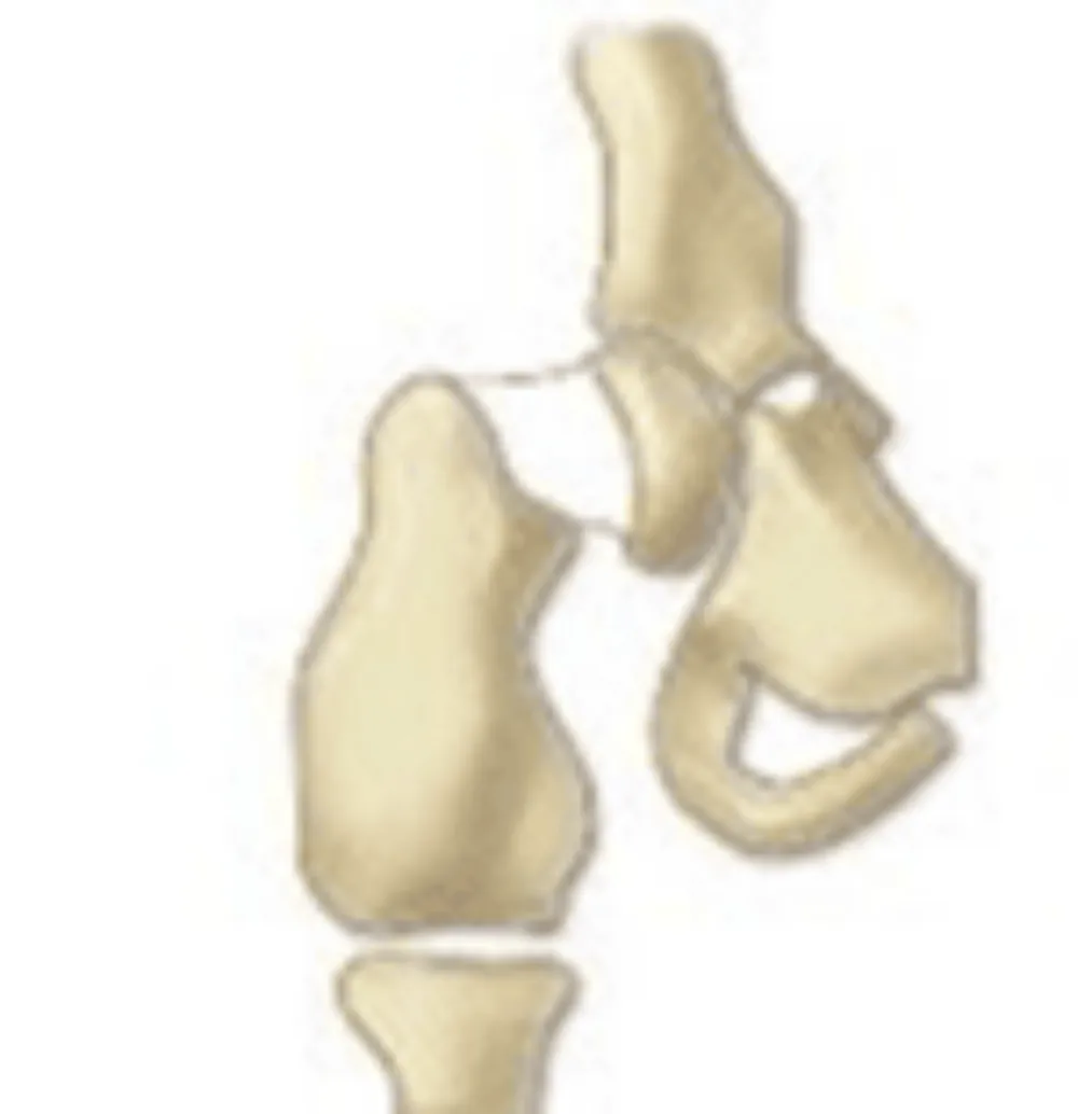 Fonte: HERRING, J. A.Tachdjian’s pediatricorthopaedics. 6. ed.Philadelphia: Elsevier,2022.