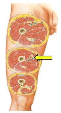 Fonte: NETTER, F. H. Atlas de anatomia humana. 7. ed. Rio de Janeiro: Elsevier, 2019.