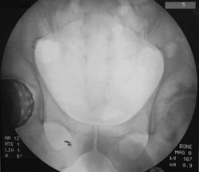 Fonte: The Adult Hip (Callaghan), 3ª ed., Figura 7.16.