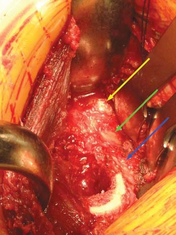 Fonte: The Adult Hip (Callaghan), 3ª ed., Figura 7.20.