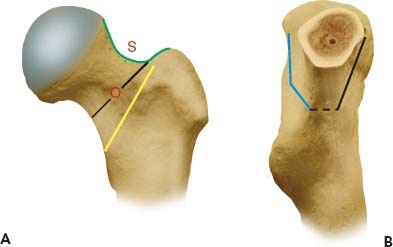 Fonte: The Adult Hip (Callaghan), 3ª ed., Figura 8.5.