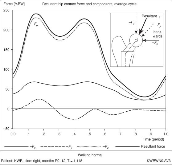 Fonte: The Adult Hip (Callaghan), 3ª ed., Figura 10.1.