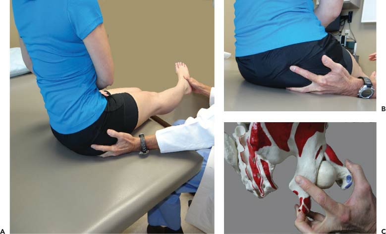 Fonte: The Adult Hip (Callaghan), 3ª ed., Figura 22.12.