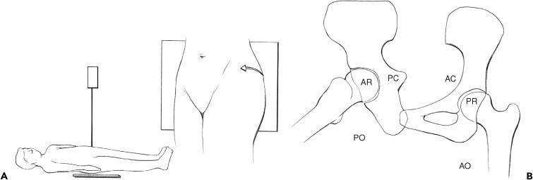 Fonte: The Adult Hip (Callaghan), 3ª ed., Figura 23.7.