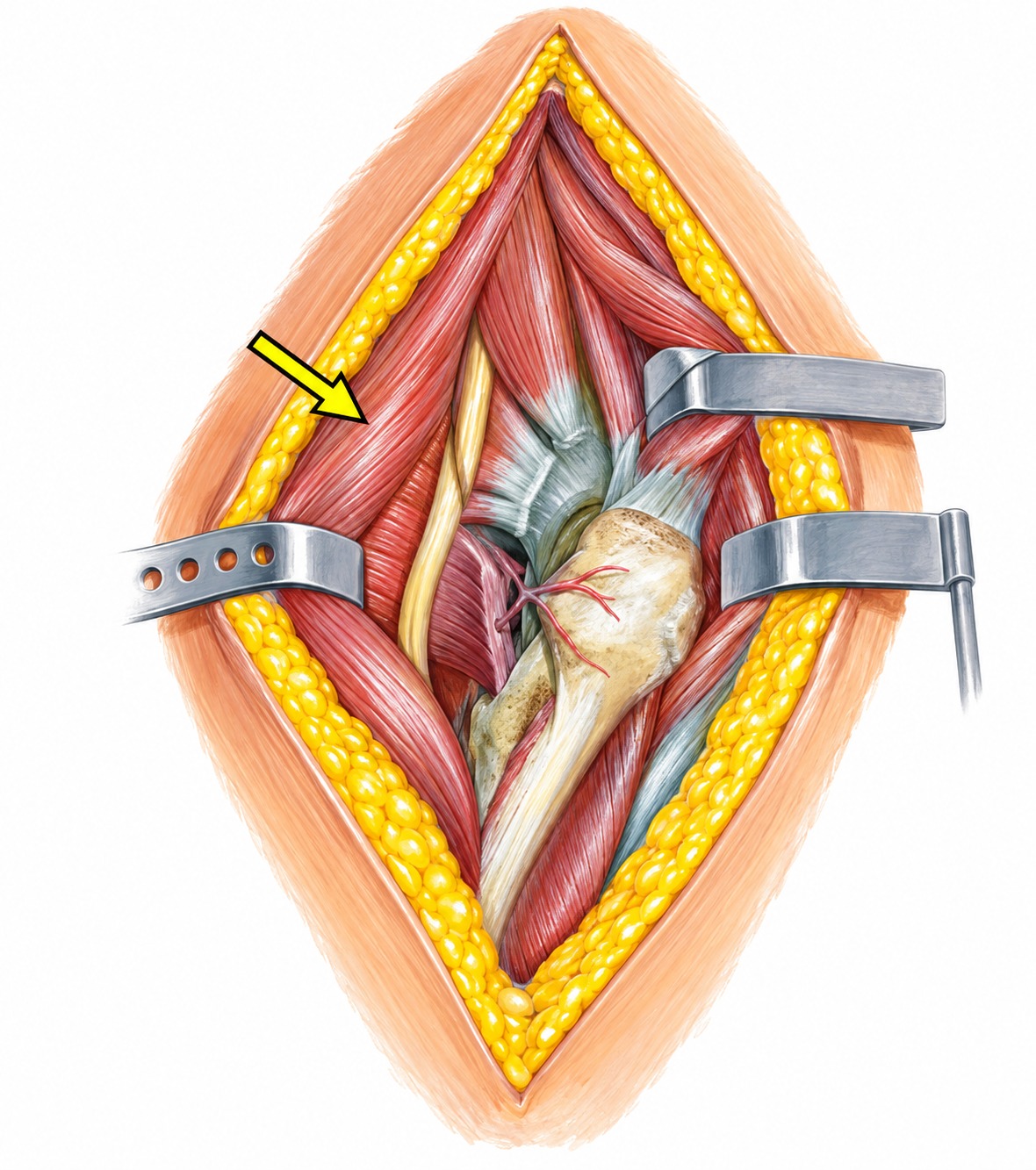 Fonte: Netter, Atlas de Anatomia Ortopédica, 2ª edição.
