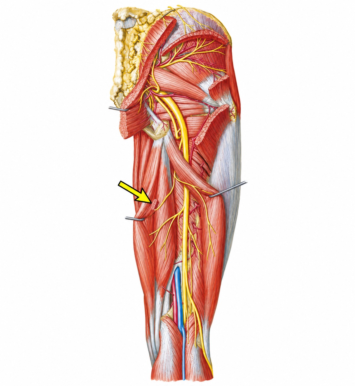 Fonte: Netter, Atlas de Anatomia Ortopédica, 2ª edição.