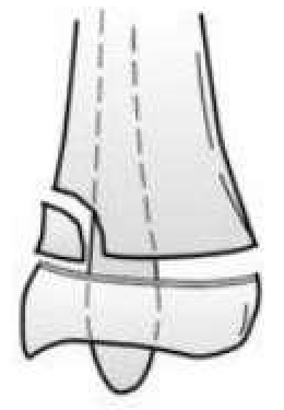 Figura da questão pediatria-0923