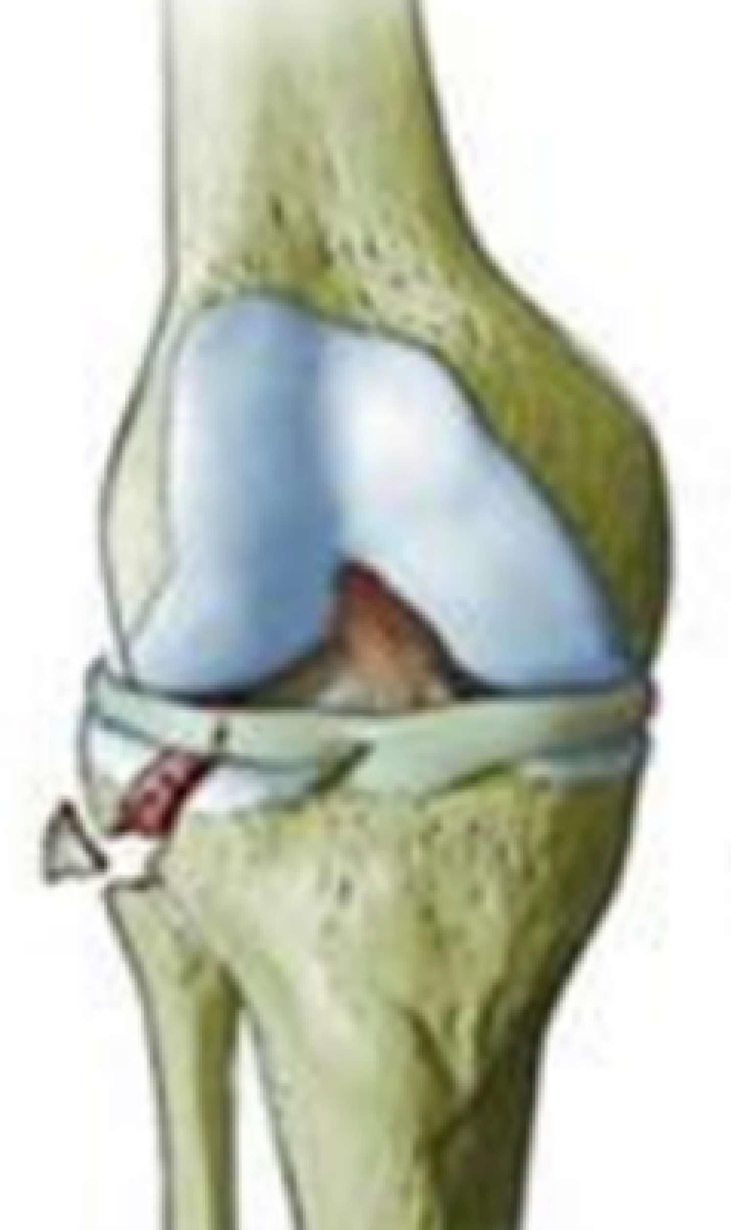 Figura da questão trauma-0558