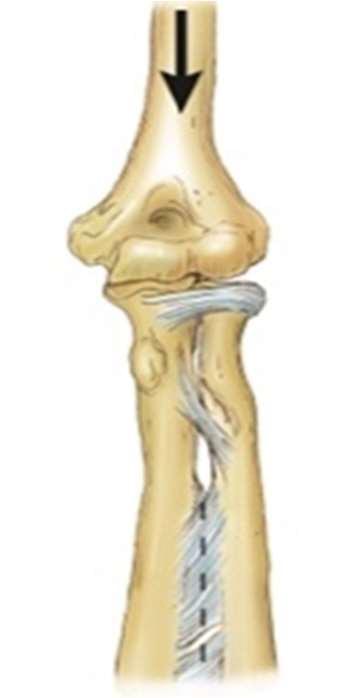 Figura da questão trauma-0682