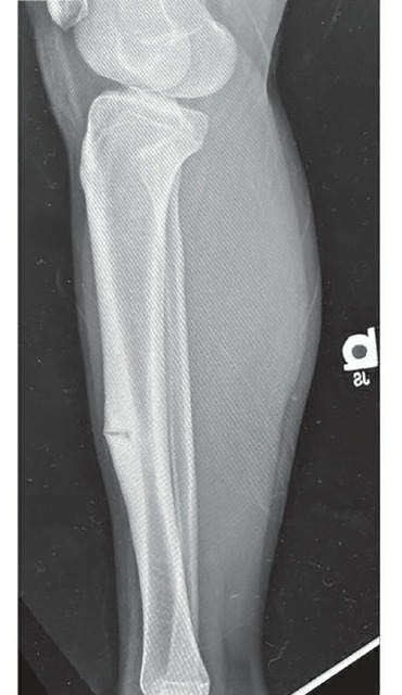 Fonte: Rockwood and Green's Fractures in Adults, 10ª ed., capítulo 24, figura 24-10A.