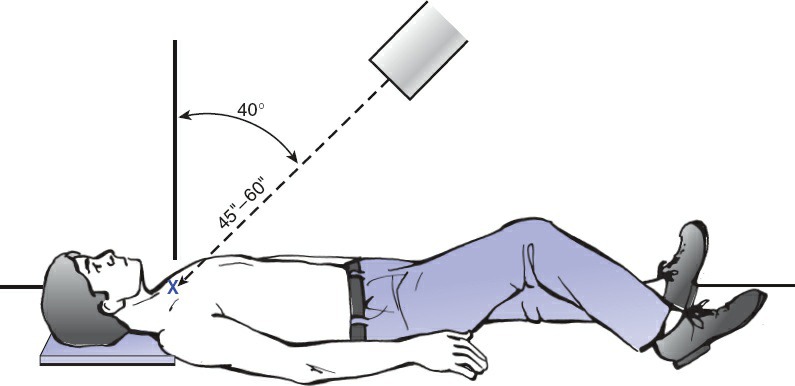 Fonte: Rockwood and Green's Fractures in Adults, 10ª ed., capítulo 32, figura 32-15.