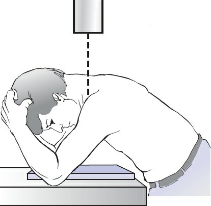 Fonte: Rockwood and Green's Fractures in Adults, 10ª ed., capítulo 32, figura 32-14.
