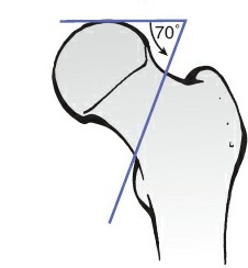 Fonte: Rockwood and Green's Fractures in Adults, 10ª ed., capítulo 53, figura 53-5.